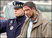 Një i mbijetuar nga sulmi