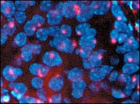 Células que produzem insulina