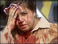 Người bị thương hôm Chủ Nhật ở Baghdad