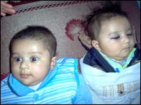 په ماشومانوکې ايدز