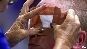 Игроку надевают повязку перед игрой в голбол