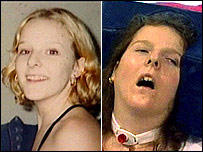Amy Pickard, antes e depois da overdose de heroína