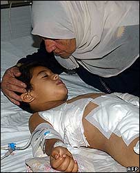 عباس يوسف عباس، 6 ساله، اهل نباتيه در اثر بمب خوشه ای زخمی شده است 