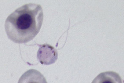 Male malaria parasite ...