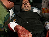 Ferido em atentado durante a Ashura