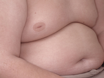 Torso of obese boy