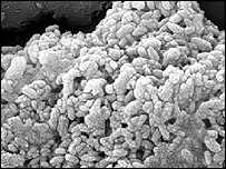 nanobacterii în artere calcifiate