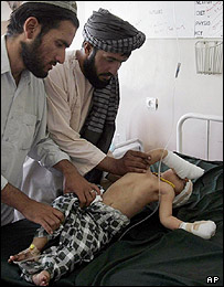 یک کودک افغان که در اثر حمله انتحاری در قندهار زخمی شده است