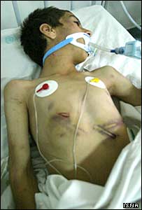 يک کودک قربانی آزار و اذيت در بيمارستان