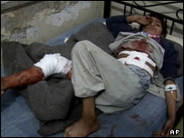 زخمی حادثه بغلان