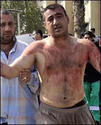 زخمی عراقی شہری