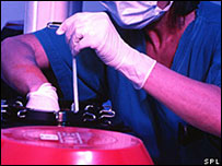 fertilização in vitro