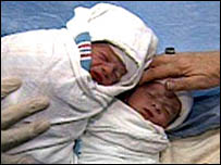 जुड़वाँ बच्चे