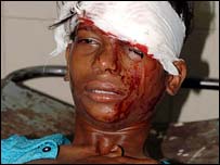 دھماکے کے بعد کا منظر