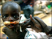 Zraněné a hladovějící dítě v ugandském Gulu