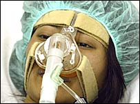 'बर्ड फ़्लू' से पीड़ित एक मरीज़