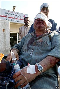 Ferido no ataque com carros-bomba em Bagdá