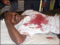 Injured man in hospital (AP photo)