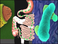 پيچش در اطفال