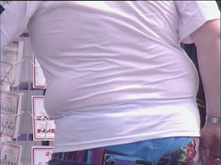Obese man's stomach