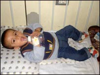 طفلی مصاب به اسهال