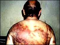 Bulunan tutsakların sırtında kırbaç izleri var