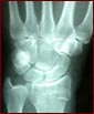 Hand X-Ray