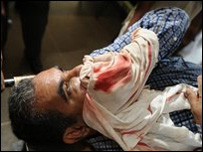 اپالی ٹیناکون