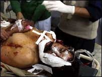 بونیر دھماکہ