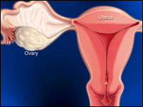 بيماری سوزاک 