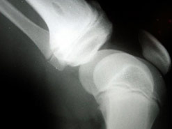 X-ray of a knee joint
