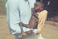 Image: Starving child in 1984 Ethiopian famine