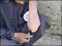 A man using a syringe