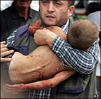 Menino liberto é carregado 