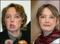 Isabelle Dinoire na época do transplante e hoje