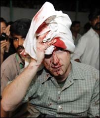 इस्लामाबाद विस्फोट में ज़ख़्मी