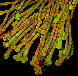 Shirley Owens, Universidade Estadual de Michigan, Estados Unidos (Foto: Cortesia do Concurso Nikon Small World)