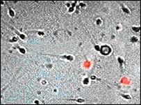 مردانہ جرثومے