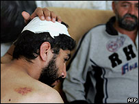 O palestino Midhat Abu Karch, de Hebron, foi ferido por colonos israelense do assentamento de Assael