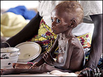 Malý Nigerijec, který je na léčení v nemocnici kvůli akutní podvýživě