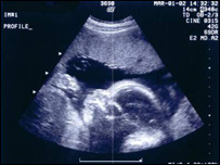  د ماشوم د زېږون وخت 