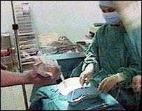 اپنی نوعیت کا پہلا آپریشن