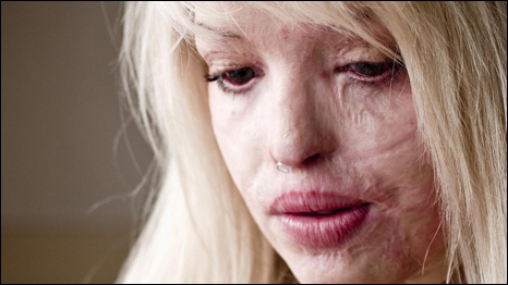 Brave Face: Katie Piper - courage after a brutal acid attack