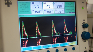 The blood flow monitor could save the NHS huge sums of money