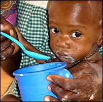 Criança desnutrida