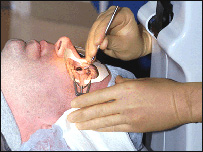 د سترګو عمليات