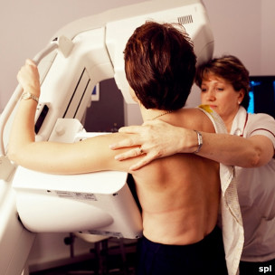 乳腺癌檢查