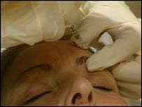 تزريق برای برطرف کردن چين و چروک پيشانی