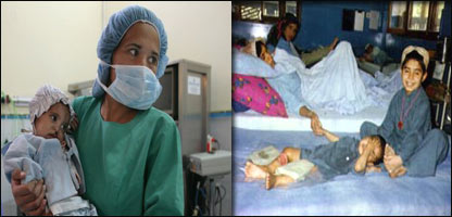 د نري رنځ له ناروغانو سره چلند