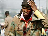 Saldırıya uğramış bir göçmen